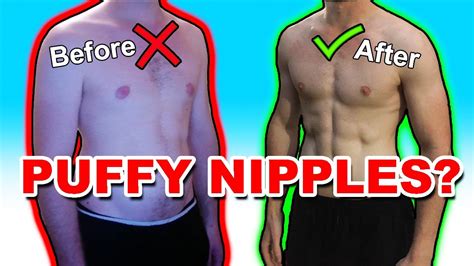 how to get rid of puffy nips|Puffy nipples in men: Remedies and causes .